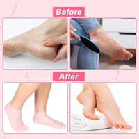 💧 1 Pair Silicone Gel Socks – Moisturizing Heel Socks for Cracked Heels & Dry Feet 🦶