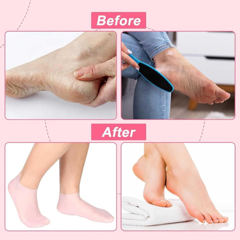 💧 1 Pair Silicone Gel Socks – Moisturizing Heel Socks for Cracked Heels & Dry Feet 🦶